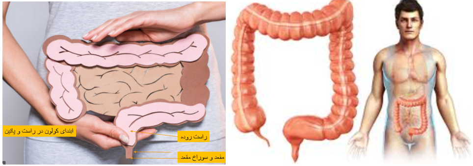 علل یبوست، تنبلی روده