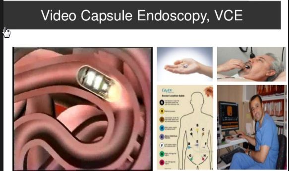 Video capsule endoscopy indication