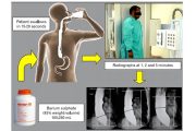 Timed barium esophagogram (TBE)