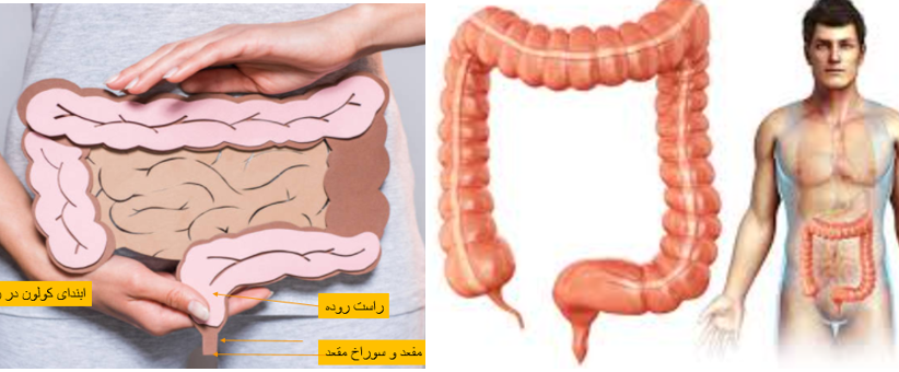 علل یبوست، تنبلی روده